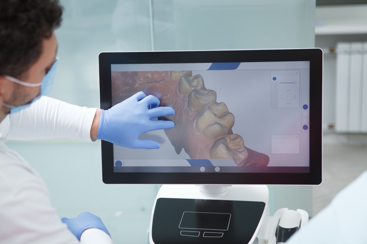 Gloved technician pointing at a digital design of a dental arch on a large screen