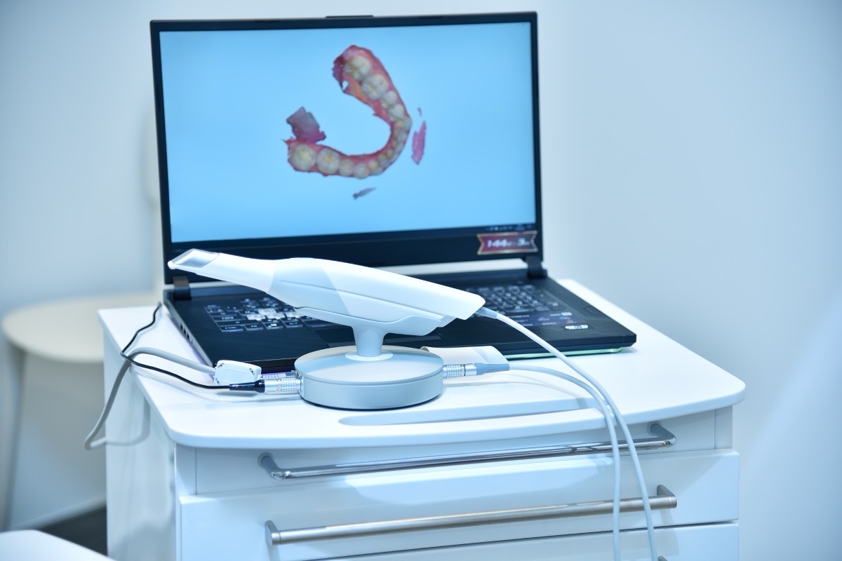 Intraoral scanner beside a laptop showing a scan of a dental arch