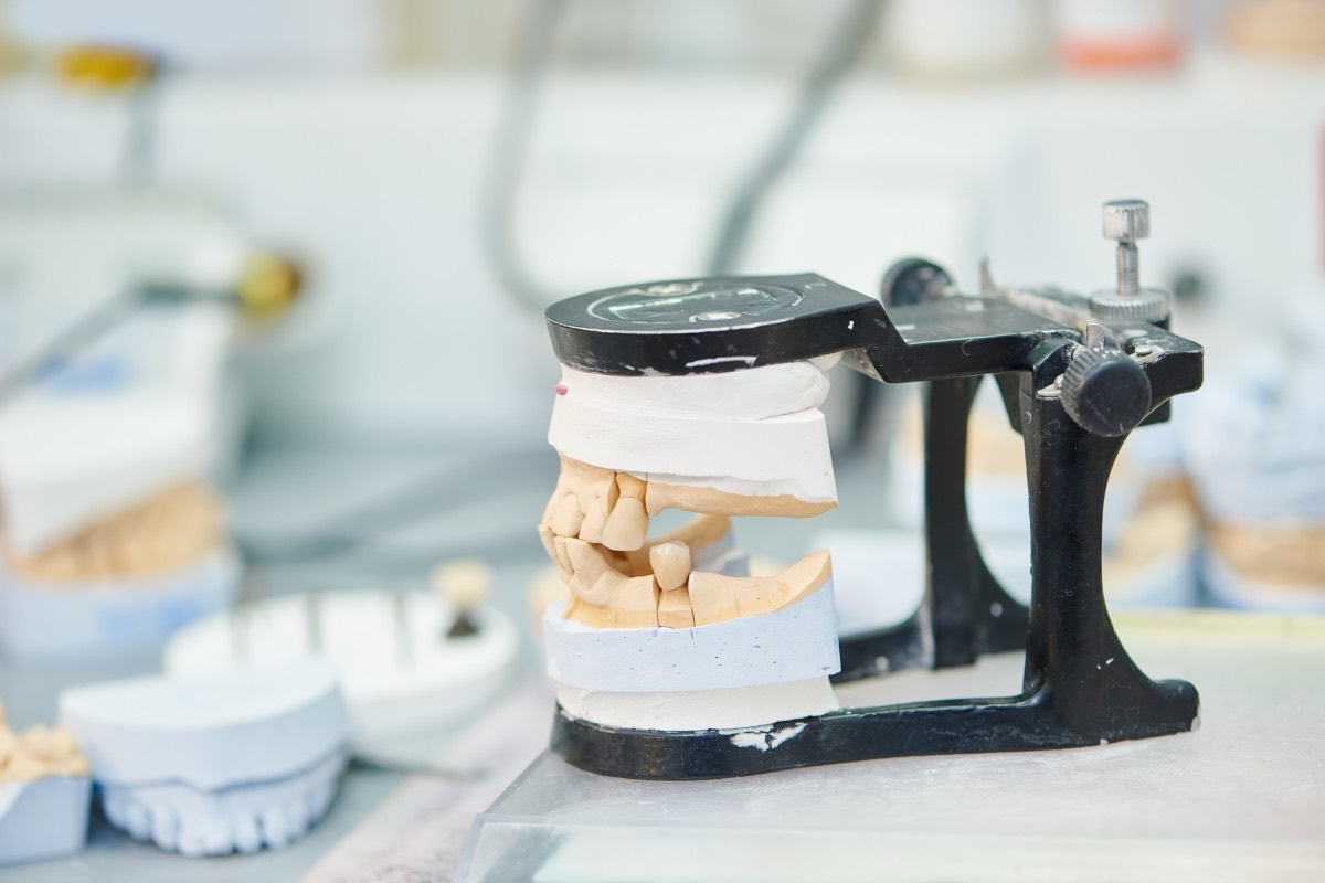 Dental articulator holding upper and lower plaster models on a laboratory bench