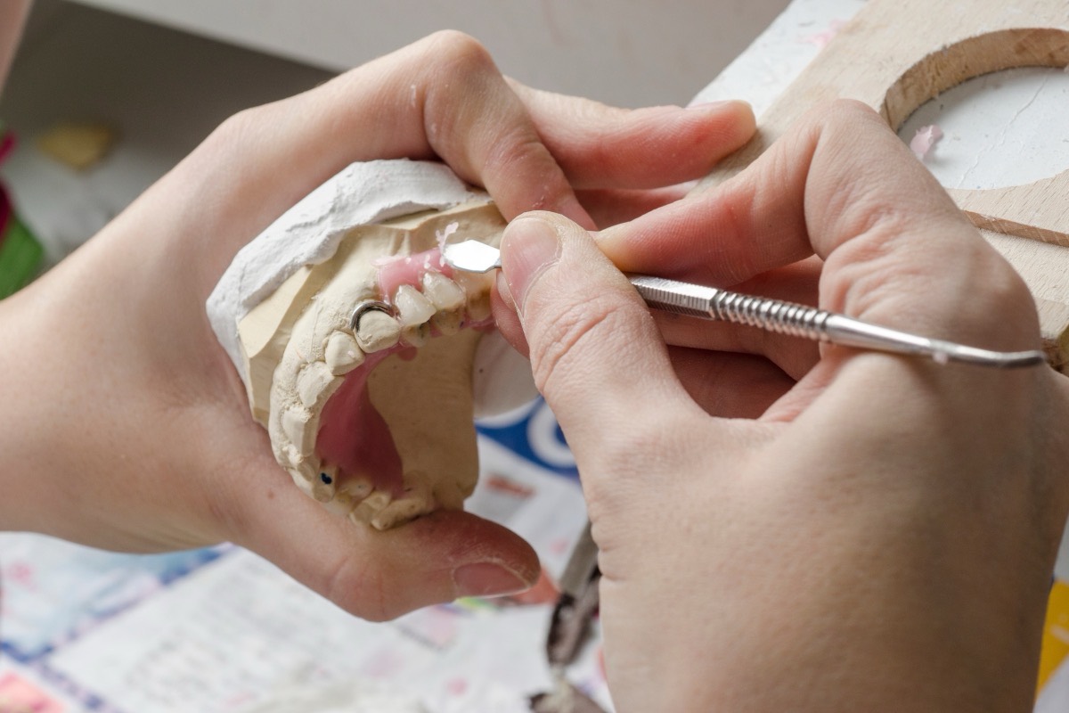 Hands shaping a partial denture on a plaster model with a dental instrument